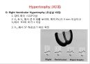 [Dankook Sports Medicine] 07. Abnormalities of the EKG.ppt 24페이지