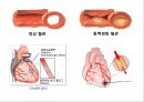  심혈관계질환 10페이지