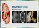 [가족정책론] 치매(Dementia).pptx 17페이지