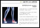 프로야구선수 손상 및 재활 치료 운동프로그램 - 야구 선수 (타자) 부상 및 처치방법.pptx 17페이지
