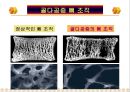 골다공증과 운동처방 ppt 4페이지