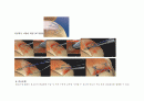  회전근개파열 케이스스터디 (회전근개손상 간호과정) - rotator cuff syndrome case study  10페이지