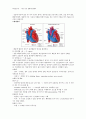  아동간호학 - 아동 심장 질환에 관해서[선천성 심질환, 후천성 심질환] 5페이지