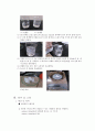[계면중합] 나일론6,10 : 나일론은 직물용의 섬유로서 널리 사용된 첫 번째 합성고분자이다. 나일론-6,10을 계면중합반응으로 제조함으로써 계면중합의 원리와 특징을 안다 3페이지