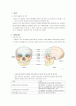 아동간호학 case study(craniosynostosis) 2페이지