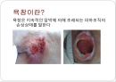 욕창예방과 관리 2페이지