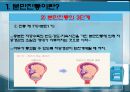 (A+) 분만진통 발표 - 개념 & 논문고찰 및 한의학적 문헌 조사.pptx 5페이지