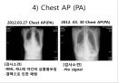 호흡기질환, 폐결핵, 폐결핵 병태생리, 간호진단 및 간호중재 15페이지