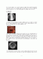 [성인간호학][Esophageal cancer][식도암] 케이스 스터디(Case Study), 문헌고찰 4페이지