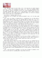 [아동간호학][Diarrhea][Rotavirus][신생아설사][로타바이러스] 케이스 스터디(Case Study), 문헌고찰 4페이지