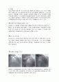 [성인간호학][Myocardial infarction][심근경색증][MI]문헌고찰 7페이지