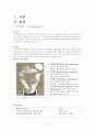 [여성간호학][자궁근종][Myoma] 케이스 스터디(Case Study), 문헌고찰 2페이지