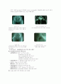 [성인간호학][대퇴골두무혈성괴사][avascular necrosis of the femoral head] 케이스 스터디(Case Study), 문헌고찰 8페이지