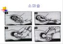 인공유산 5페이지