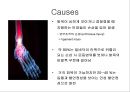 만성 발목 염좌 재활 운동 가이드 (발목의 해부학, 발목 염좌 이해, 발목의 주차별 재활 운동 방법 소개).PPT자료 4페이지