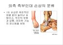 만성 발목 염좌 재활 운동 가이드 (발목의 해부학, 발목 염좌 이해, 발목의 주차별 재활 운동 방법 소개).PPT자료 6페이지