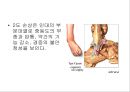 만성 발목 염좌 재활 운동 가이드 (발목의 해부학, 발목 염좌 이해, 발목의 주차별 재활 운동 방법 소개).PPT자료 7페이지
