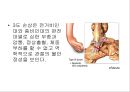만성 발목 염좌 재활 운동 가이드 (발목의 해부학, 발목 염좌 이해, 발목의 주차별 재활 운동 방법 소개).PPT자료 8페이지