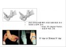 만성 발목 염좌 재활 운동 가이드 (발목의 해부학, 발목 염좌 이해, 발목의 주차별 재활 운동 방법 소개).PPT자료 11페이지
