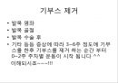 발목 기부스 제거 후 재활 가이드 북 (기부스 제거 후 운동, 주차별 재활 운동).PPT자료 2페이지