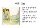 발목 기부스 제거 후 재활 가이드 북 (기부스 제거 후 운동, 주차별 재활 운동).PPT자료 4페이지