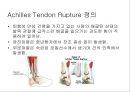 아킬레스 건염 재활 운동 (Achilles Tendinitis 정의, 원인, 진단, 분류, Paratenonitis(건주위염)치료, Tendinosis(퇴행성 건염) 치료, Achilles Tendon Rupture 정의, 증상, 아킬레스건 수술, 재활 운동).PPT자료 21페이지