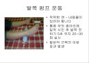 아킬레스 건염 재활 운동 (Achilles Tendinitis 정의, 원인, 진단, 분류, Paratenonitis(건주위염)치료, Tendinosis(퇴행성 건염) 치료, Achilles Tendon Rupture 정의, 증상, 아킬레스건 수술, 재활 운동).PPT자료 33페이지