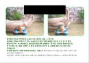 아킬레스 건염 재활 운동 (Achilles Tendinitis 정의, 원인, 진단, 분류, Paratenonitis(건주위염)치료, Tendinosis(퇴행성 건염) 치료, Achilles Tendon Rupture 정의, 증상, 아킬레스건 수술, 재활 운동).PPT자료 34페이지