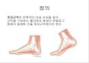 족저 근막염 재활 운동 가이드 - 족저 근막염의 이해와 운동 방법 (족저 근막염 정의, 족저 근막 통증 부의, 징후 및 증상, 평가 방법, 원인, 진단법, 치료 및 재활과정, 스트레칭 운동, 재활운동).PPT자료 3페이지