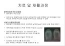 족저 근막염 재활 운동 가이드 - 족저 근막염의 이해와 운동 방법 (족저 근막염 정의, 족저 근막 통증 부의, 징후 및 증상, 평가 방법, 원인, 진단법, 치료 및 재활과정, 스트레칭 운동, 재활운동).PPT자료 19페이지