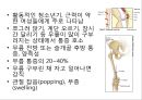 무릎의 신체 검진 및 질환 소개.PPT자료 34페이지