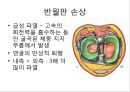 무릎의 신체 검진 및 질환 소개.PPT자료 43페이지