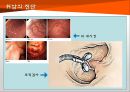 위암 7페이지