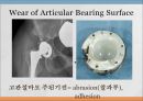THRA PPT Anatomy 와 관련질환 수술방법  25페이지