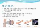 만성-신장질환 13페이지
