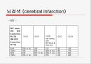 뇌경색 (Cerebral Infarction) 케이스  15페이지