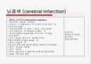 뇌경색 (Cerebral Infarction) 케이스  21페이지