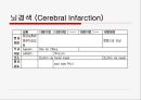 뇌경색 (Cerebral Infarction) 케이스  27페이지