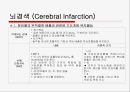 뇌경색 (Cerebral Infarction) 케이스  29페이지
