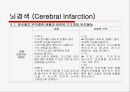 뇌경색 (Cerebral Infarction) 케이스  30페이지