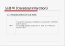 뇌경색 (Cerebral Infarction) 케이스  39페이지