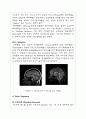 진단 방사선과 PK 레포트 MRI  5페이지