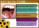 흡연과 치주질환ppt 6페이지