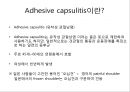 오십견 재활 운동 (Adhesive capsulitis, 1단계 통증 경감 시기, 2단계 적극적 가동범위 회복, 3단계 견갑대 강화 시기).PPT자료 2페이지
