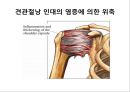 오십견 재활 운동 (Adhesive capsulitis, 1단계 통증 경감 시기, 2단계 적극적 가동범위 회복, 3단계 견갑대 강화 시기).PPT자료 4페이지
