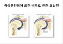 오십견 재활 운동 (Adhesive capsulitis, 1단계 통증 경감 시기, 2단계 적극적 가동범위 회복, 3단계 견갑대 강화 시기).PPT자료 5페이지