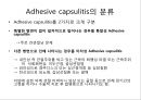 오십견 재활 운동 (Adhesive capsulitis, 1단계 통증 경감 시기, 2단계 적극적 가동범위 회복, 3단계 견갑대 강화 시기).PPT자료 12페이지
