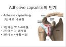 오십견 재활 운동 (Adhesive capsulitis, 1단계 통증 경감 시기, 2단계 적극적 가동범위 회복, 3단계 견갑대 강화 시기).PPT자료 13페이지