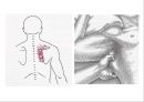 오십견 재활 운동 (Adhesive capsulitis, 1단계 통증 경감 시기, 2단계 적극적 가동범위 회복, 3단계 견갑대 강화 시기).PPT자료 21페이지