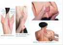 오십견 재활 운동 (Adhesive capsulitis, 1단계 통증 경감 시기, 2단계 적극적 가동범위 회복, 3단계 견갑대 강화 시기).PPT자료 22페이지